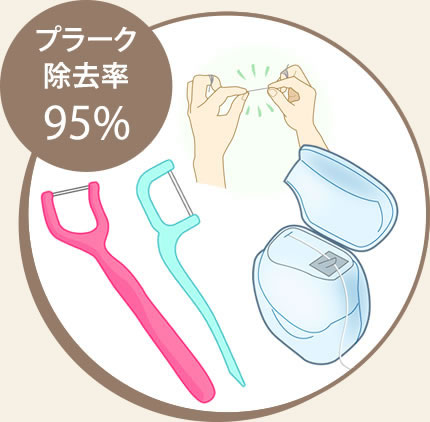 歯ブラシと歯間ブラシに加えて、フロス(糸ようじ)を使うことで、プラーク除去率95%