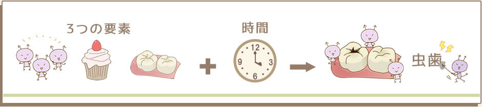 「ばい菌」、「食べる物」、「歯の質」の3つの要素と「時間」の組み合わせが虫歯を作ります。